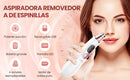 REMOVEDOR DE ESPINILLAS Y PUNTOS NEGROS
