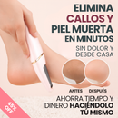 Removedor de Callos Eléctrico Recargable – ¡Pies Suaves al Instante y desde casa!